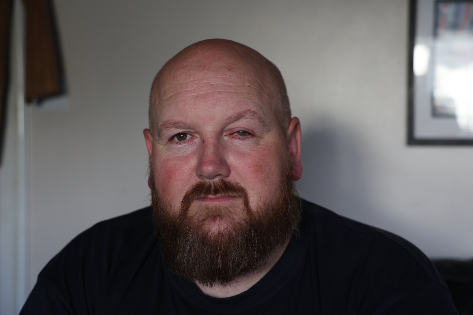 Portrait of Paul Laskey, an acid attack victim.