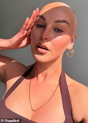 'It's the least of my worries,' she said of her hair loss