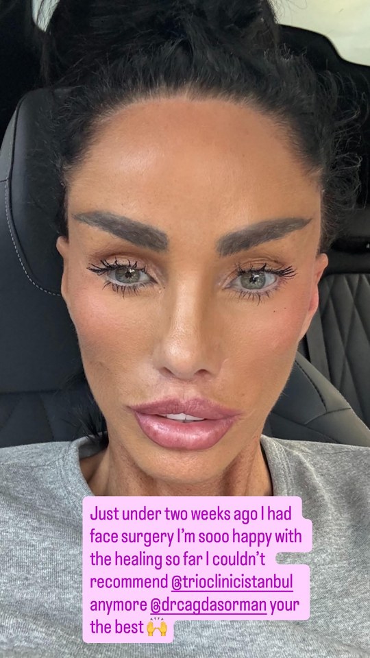 Close-up selfie of Katie Price two weeks post-face surgery.