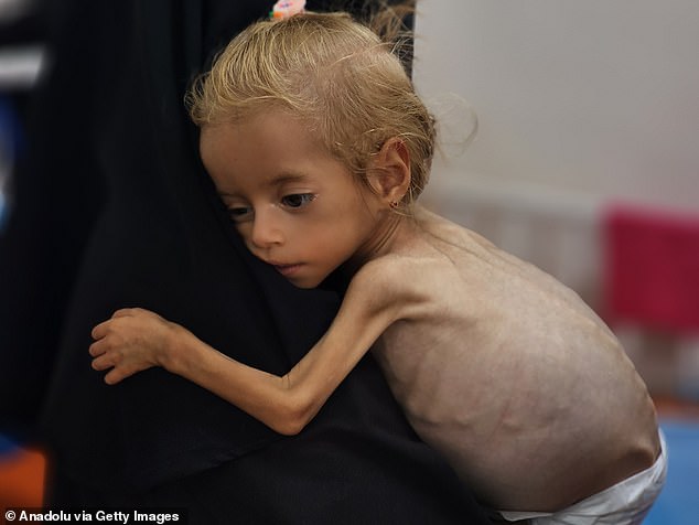 UN-backed experts have warned of widespread famine unfolding in the territory and claims scores of Palestinians have been shot while trying to claim aid near distribution sites. Pictured: Two-year-old Sham Kadih is the latest child in Gaza to be pictured reportedly suffering from severe malnutrition