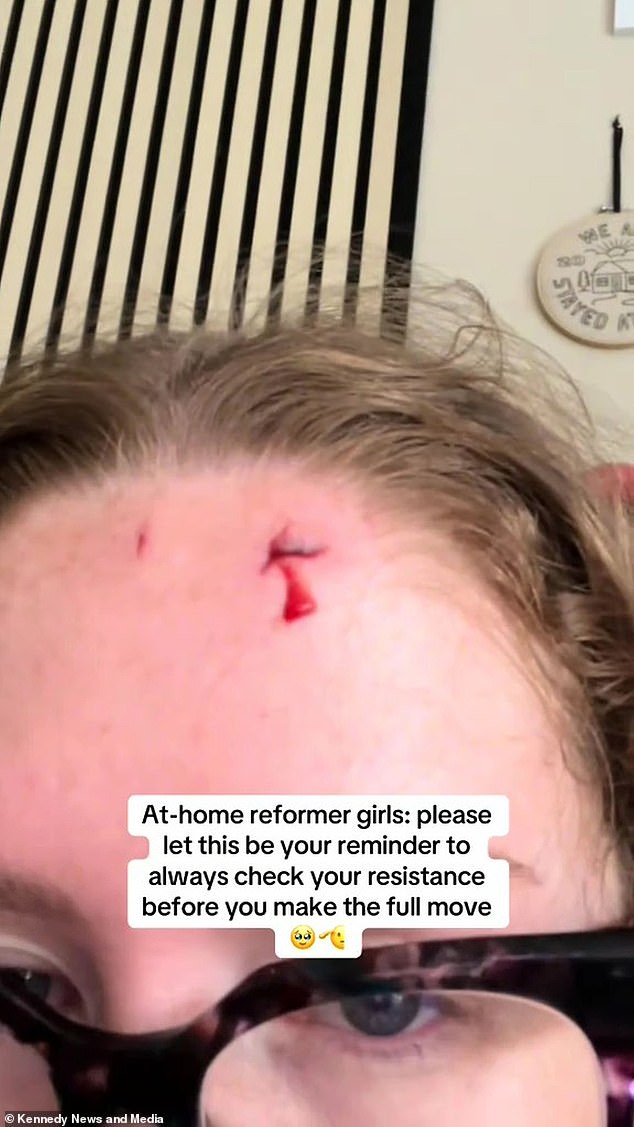 Annabelle Rose, from Durham was enjoying an early morning workout on 14 July, completing a move she'd performed countless times when she suddenly plunged forwards, cutting her head