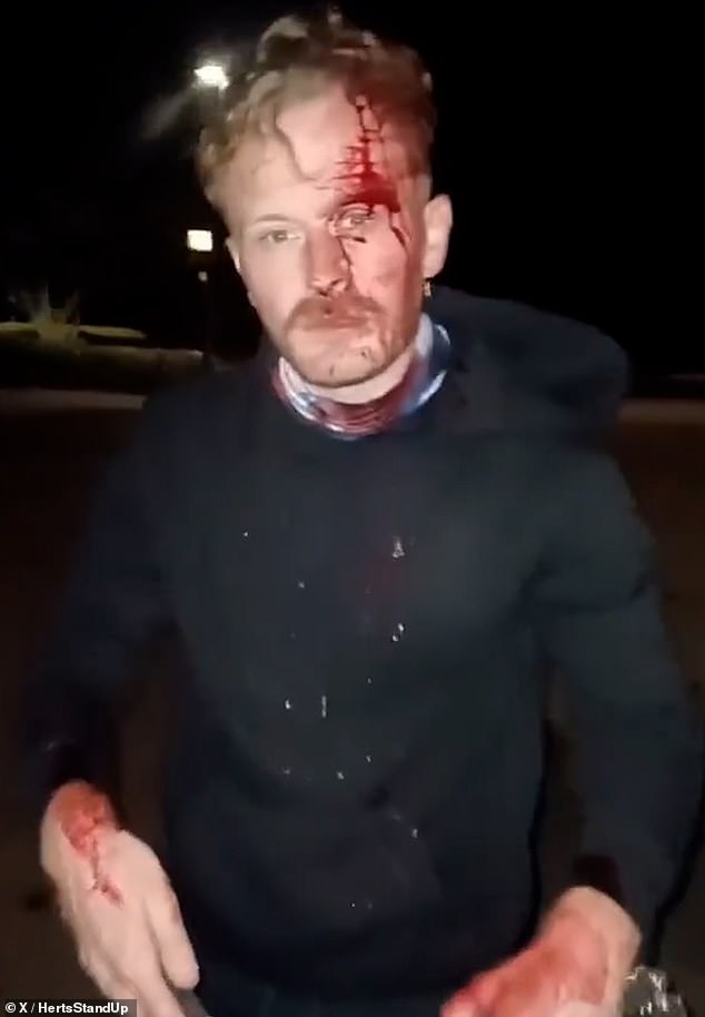 It comes after a man was left with a severe gash and blood streaming down his face after he claims he was attacked with 'a glass bottle containing a lit rag' just moments after putting up England flags in his home town