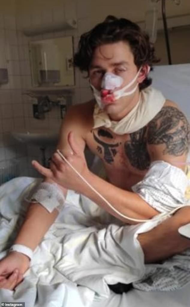 Rudat (pictured in the hospital) was sliced with a six-inch blade across his face