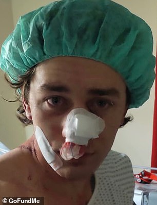Rudat (pictured) needed extensive surgery after the attack