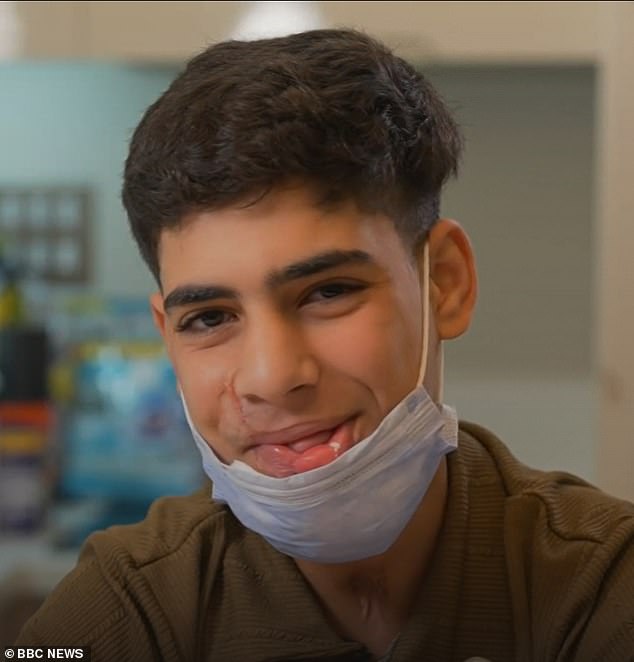 Majd Alshaghnobi (pictured) suffered severe facial injuries and a shattered leg while searching for food with two friends last year