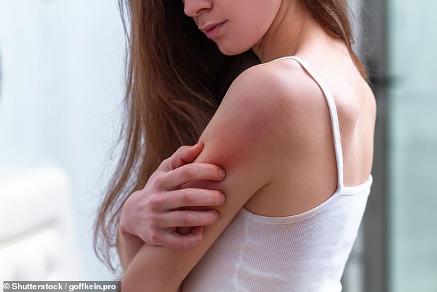 Neglecting to shower can cause inflamed hair follicles, itchy, scaly skin or more severe skin infections (stock image)