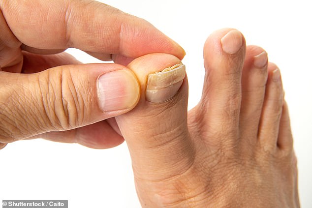 Thickened or damaged toenails can be agonising, limit mobility and trigger dangerous infections