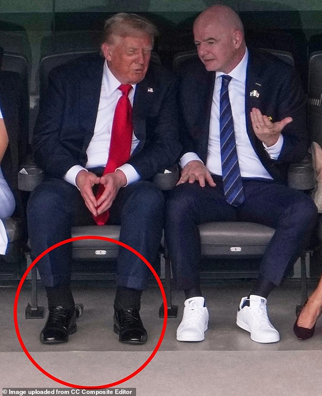For months, speculation about his health have come via photos showing dark blue marks on his hand and swollen ankles