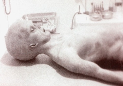 Collage of alleged Roswell alien autopsy stills.