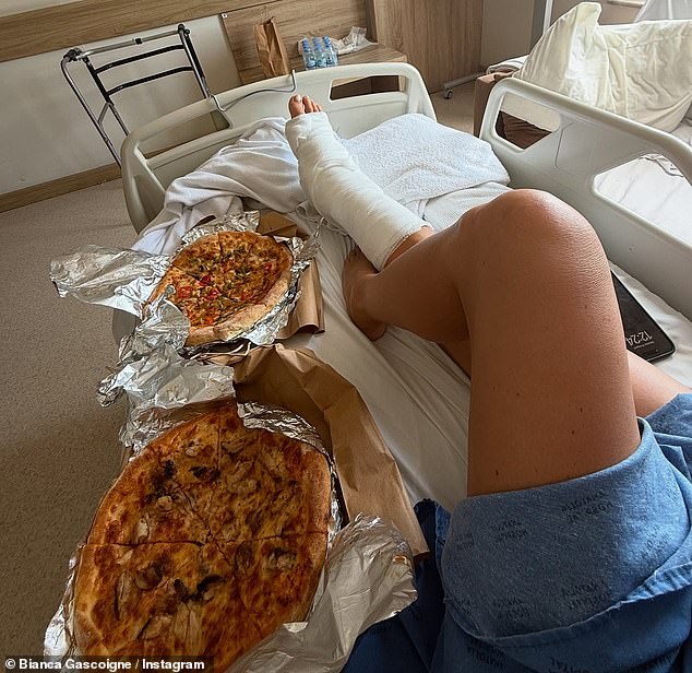 The TV personality, 38, was on a golf buggy during her getaway in Turkey when the vehicle crashed, leaving her with a broken ankle