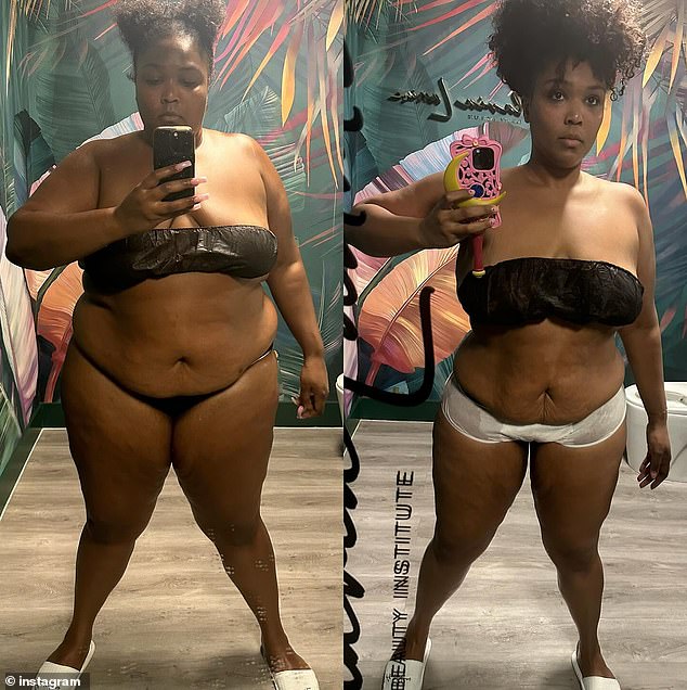Her post comes weeks after she shared side-by-side photos of her dramatic weight loss as she modeled paper undergarments ahead of getting a lymphatic massage. The star also divulged how she transformed her body