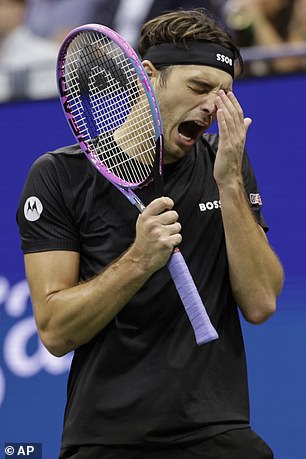 Fritz took to social media after the match to reference his wardrobe malfunction