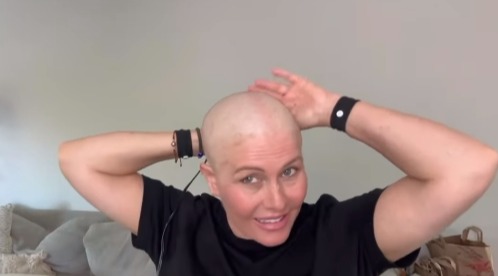 Nicole Eggert, bald after shaving her head due to breast cancer.