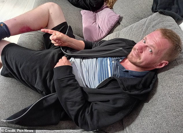 Adam Abrehart said he started to feel really sick, with a bad headache and a temperature, soon after the bite first occurred