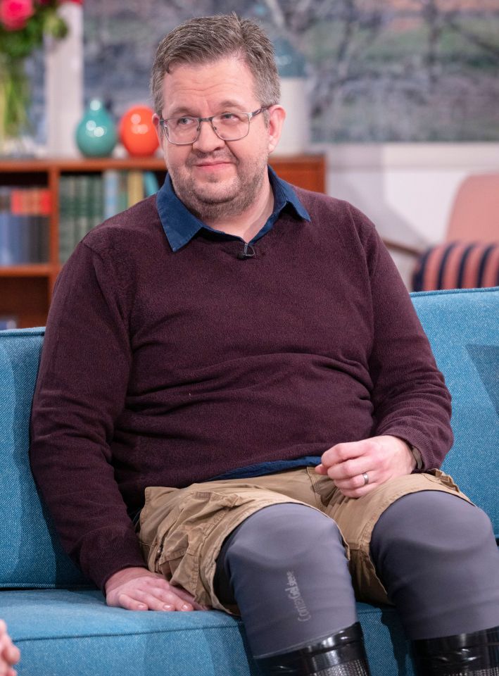 Vascular surgeon Neil Hopper, wearing prosthetic legs, sits on a sofa.