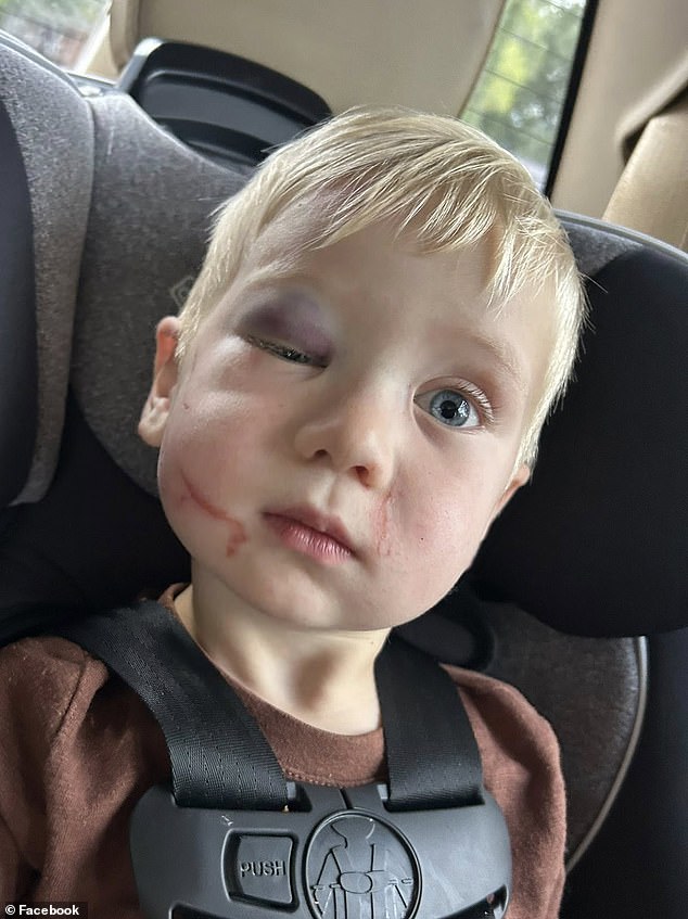 Pictured: Clay's swollen face
