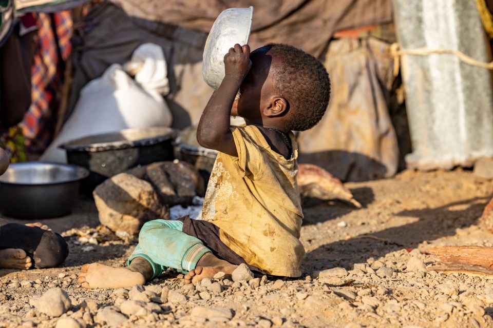 Malnourished child eating from a bowl.