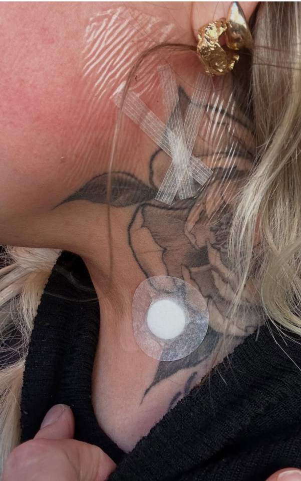 Close-up of a woman's neck showing bandages and a small circular dressing over a tattoo, following thyroid surgery.