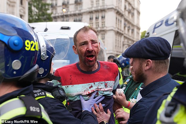 A man with a bloody eye is pushed back by police officers during the Unite The Kingdom march