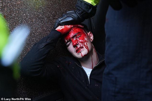 A person with blood pouring from a head wound is attended to by police at the intersection of Whitehall and Trafalgar Square during the Unite the Kingdom march