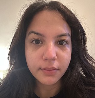 After the Skin Krush LED mask
