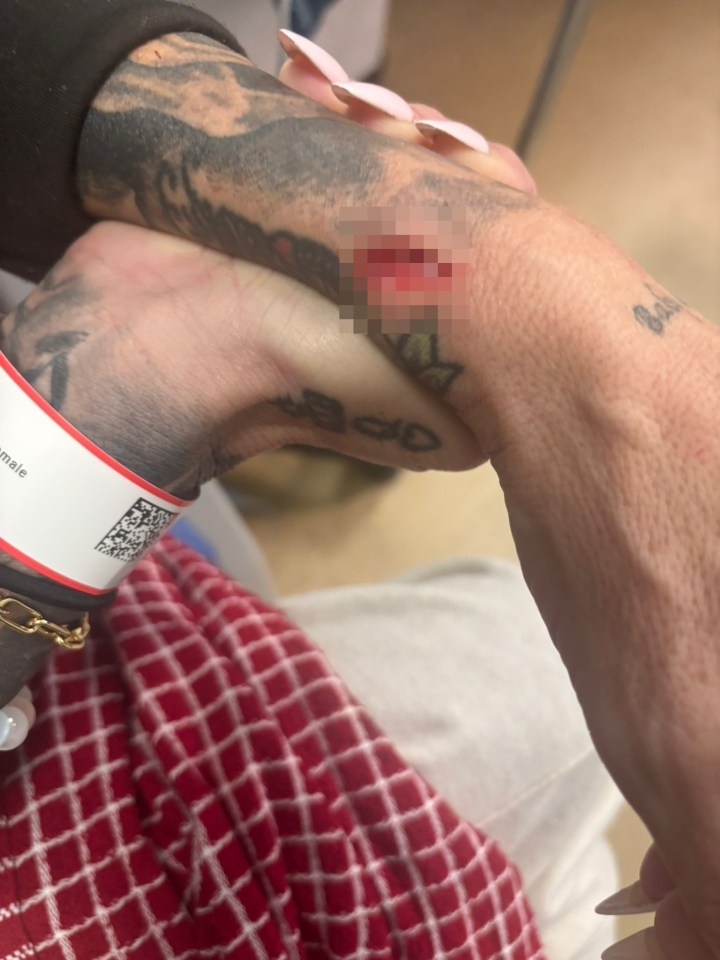 Close-up of a deep cut on a tattooed wrist.