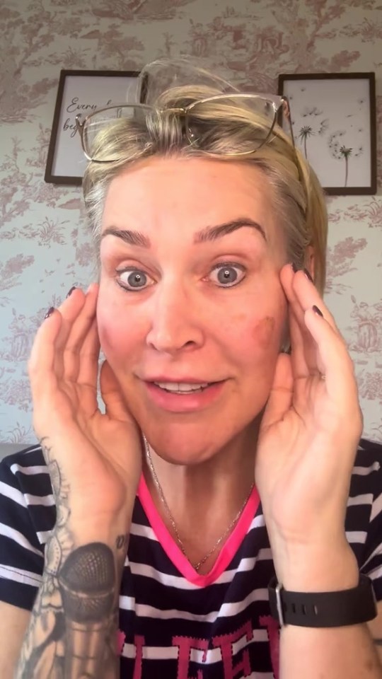 Jo O'Meara from S Club 7 showing her acne.