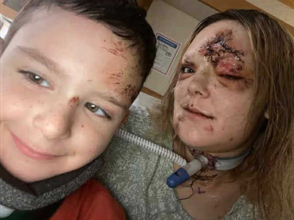 Savanah White and her son Malakye White pictured in hospital after an accident.