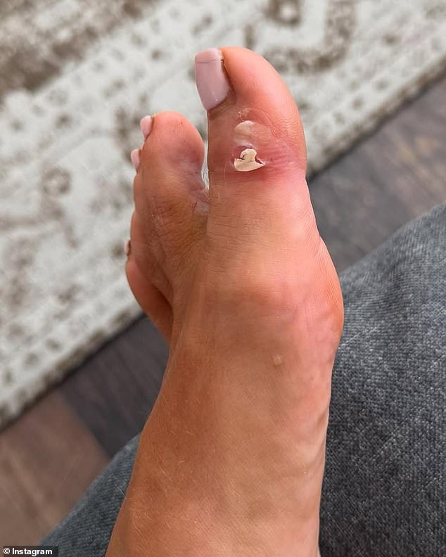 Giving her fans a glimpse of the reality behind the glitzy BBC competition, the TV personality, 37, shared an album of pictures, featuring gruesome images of her feet torn to pieces