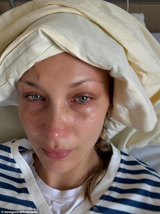 'I’m sorry I always go MIA I love you guys,' wrote the Vogue cover girl in her Instagram caption as she shared a collection of photos while getting treatment