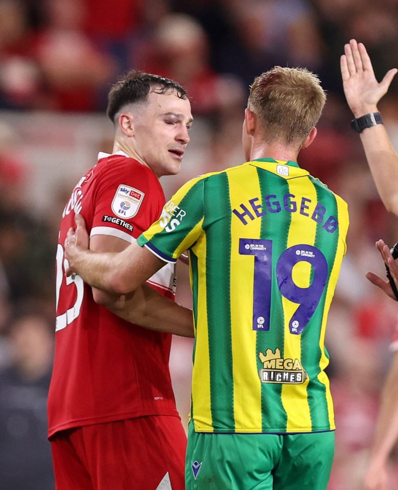 George Edmundson of Middlesbrough with a facial injury during the Sky Bet Championship match.