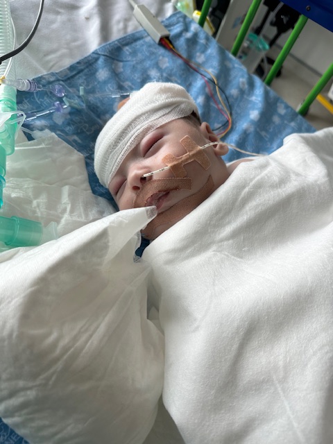 Infant with head bandage in hospital bed.