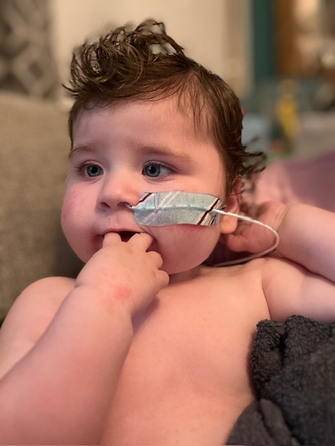 Baby with nasal cannula.