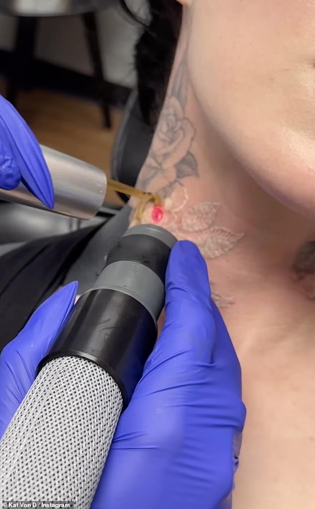 Kat also revealed she is in the process of lasering some of her artwork, including a rose on her neck, as she keeps her Instagram followers up to date with the process