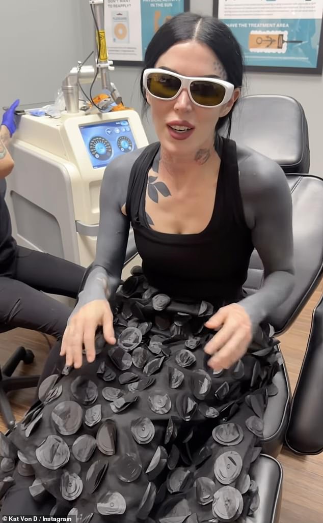 Kat added: 'I think I had been fed up with a lot of the tattoos I got over the years for a long time'