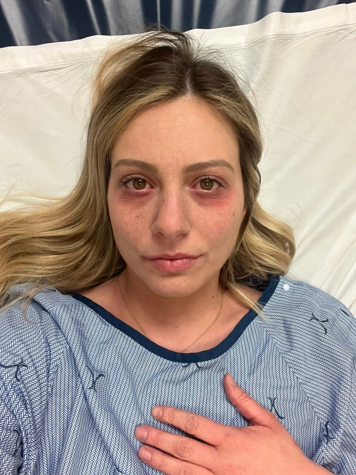 Raylee Reinhart lying on a hospital bed with red, puffy eyes and wearing a hospital gown.