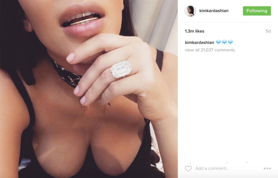 Kim Kardashian flashing a $4.5 million diamond engagement ring and a grill in her mouth.