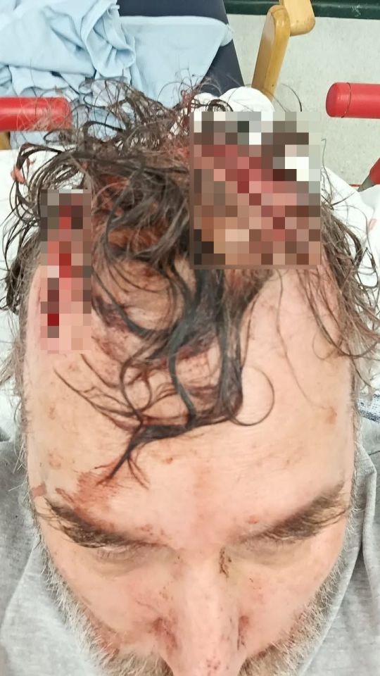 Mark Taylor's head showing serious wounds.