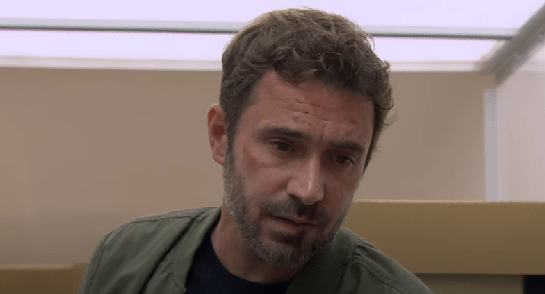 A man with a bruised face.