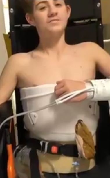 Teenager Loren Schauers who lost his lower body in a forklift accident.