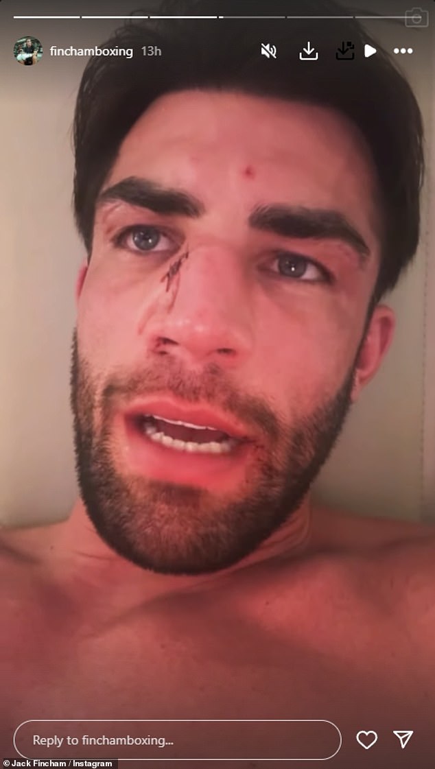 During the match, Jack was downed twice and was cut on the nose before his corner pulled him out of the fight in the second round