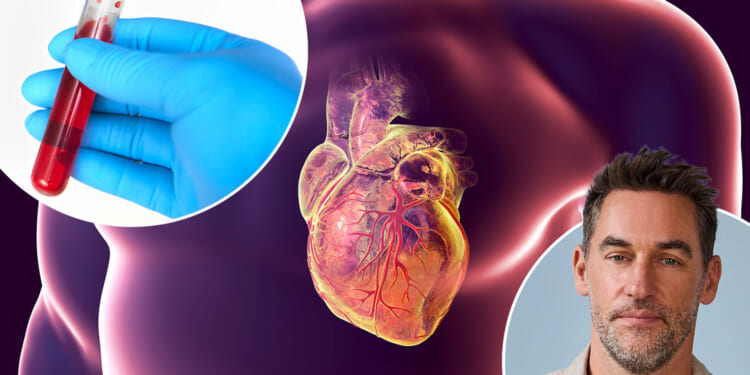I'm a nutritionist with sky-high cholesterol like '1 in 2 Brits' - it's 'silent' but deadly, so here's how to catch it