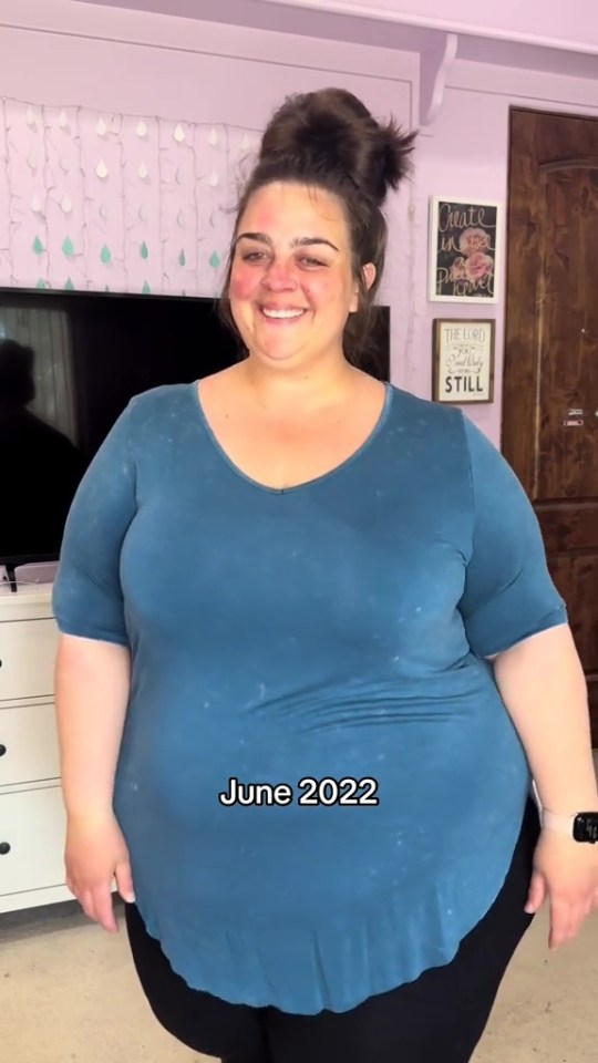 Woman in teal shirt before weight loss.