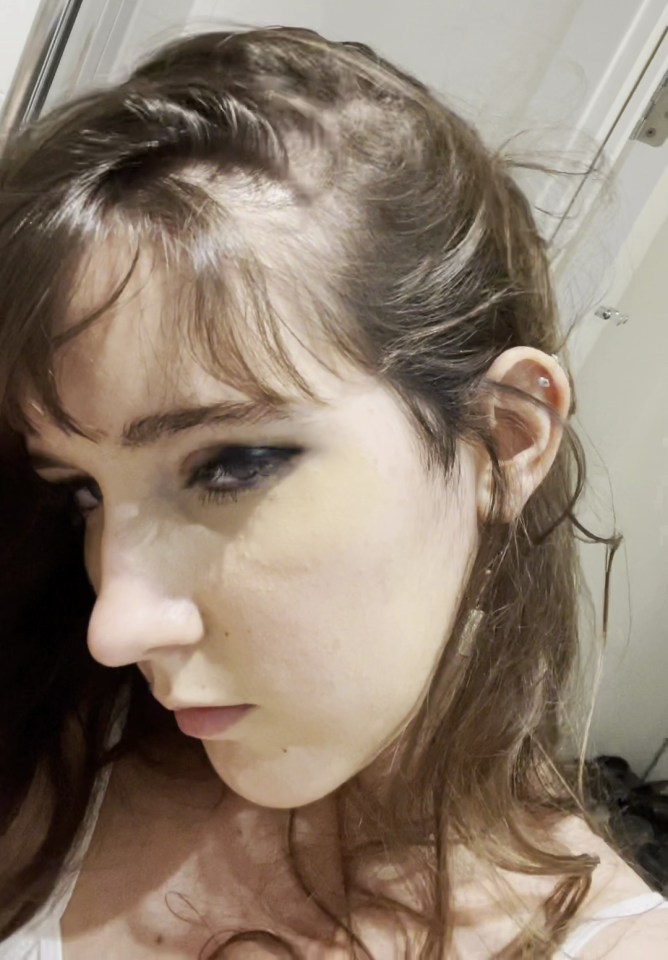 A woman with dark hair and dark eye makeup shows a side profile of her head with areas of thinning hair visible on her scalp.