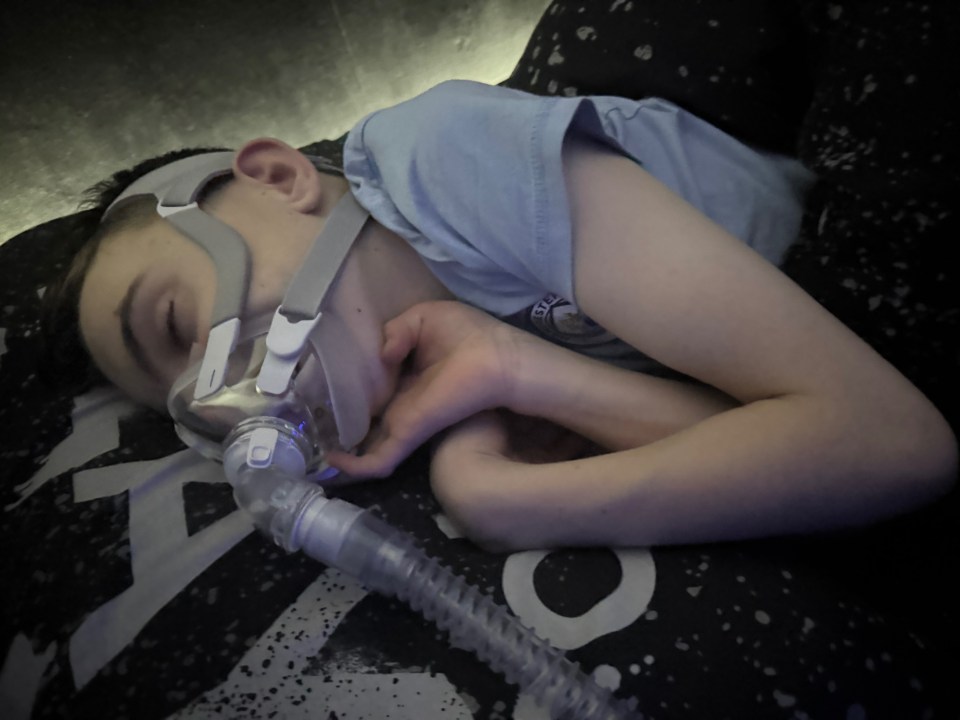 A young boy sleeping with a nasal cannula and clear breathing tube.
