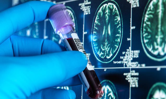 Thousands of Britons to receive cheap blood tests for Alzheimer's in landmark trial