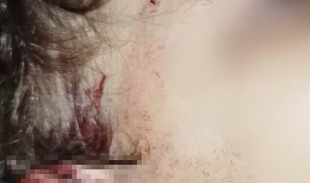 The two-year-old boy, named locally as Ismaël, was found by his parents covered in blood and rat droppings in his home