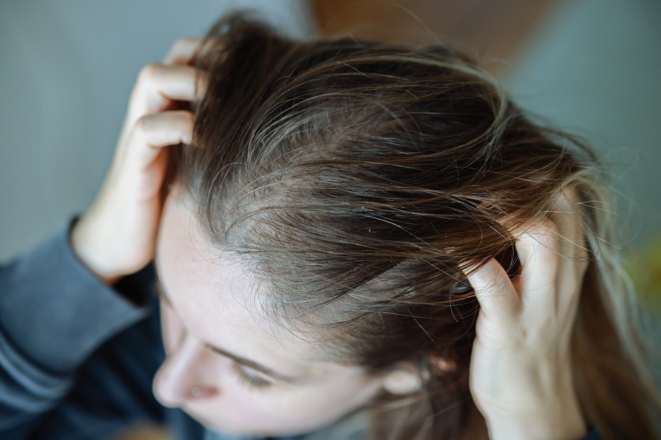 Woman, hair and worried of scalp dandruff on studio background to scratch allergy, eczema or head lice. Female model, itching scalp and haircare problem of damaged texture, dry skincare or dermatitis