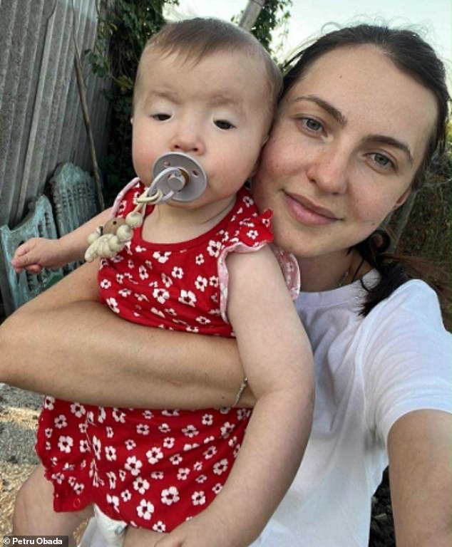 Petru and Natalia Obada were told their nine-month-old daughter Sophia was born with a rare disease and without surgery she could permanently lose her sight (Natalia and Sophia)