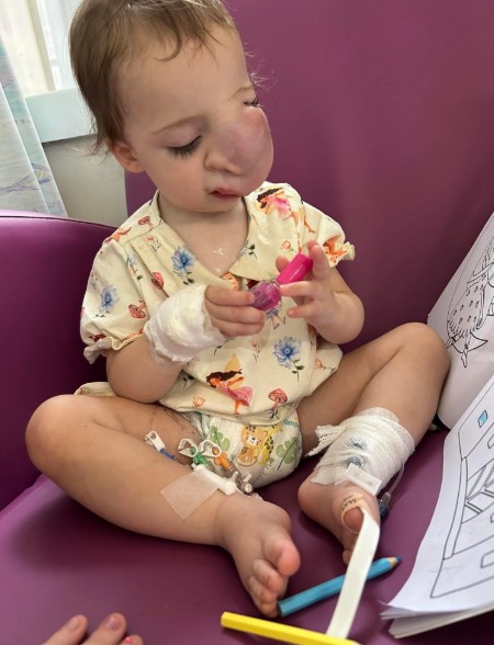 Toddler with facial hemangioma playing with nail polish.
